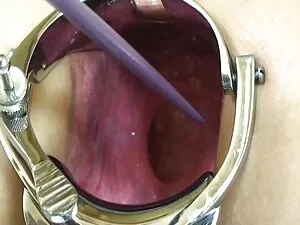 Un ragazzo che è ans ...